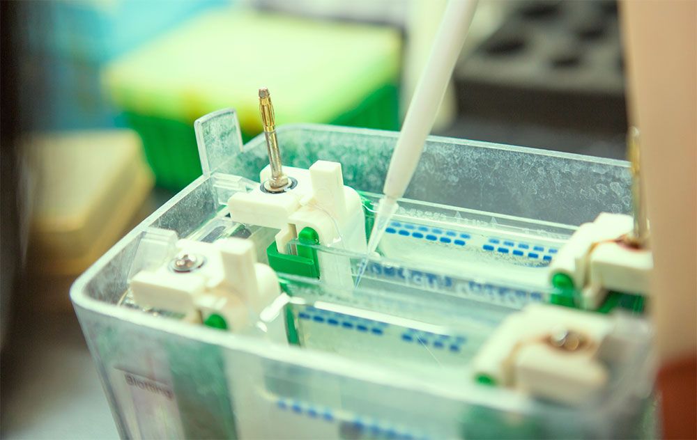 Western Blot & Protein Analysis