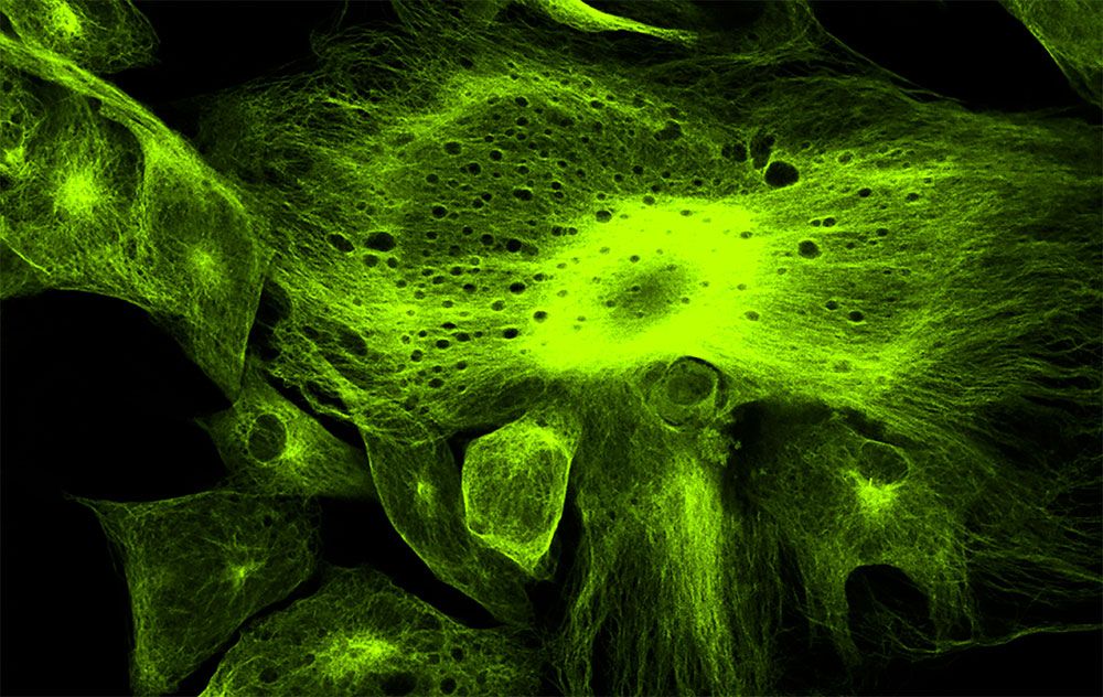 Immunostaining & Microscopy